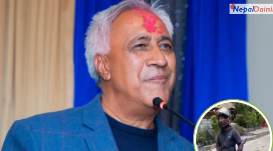 नेपालमा जलन उपचारका लागि पर्याप्त स्रोत–साधन छैनन् : चन्द्र भण्डारी