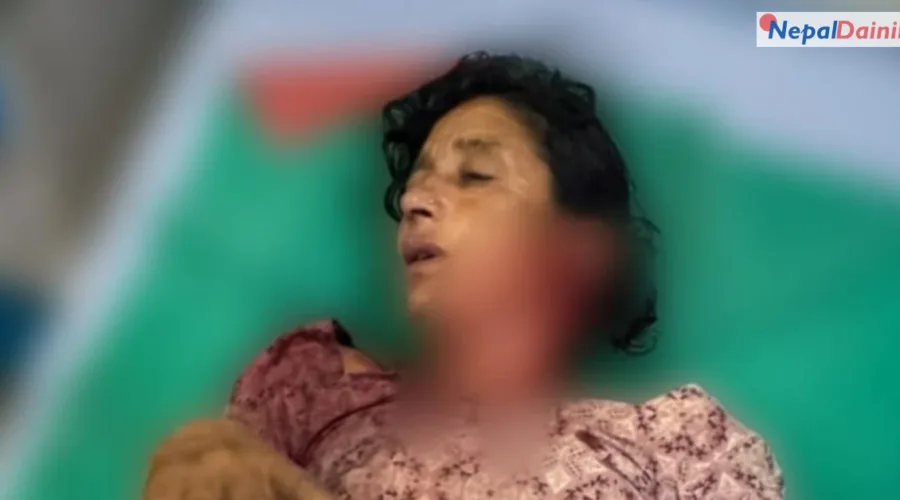 शुक्लाफाँटा जंगलमा बाघको आक्रमण, महिला घाइते